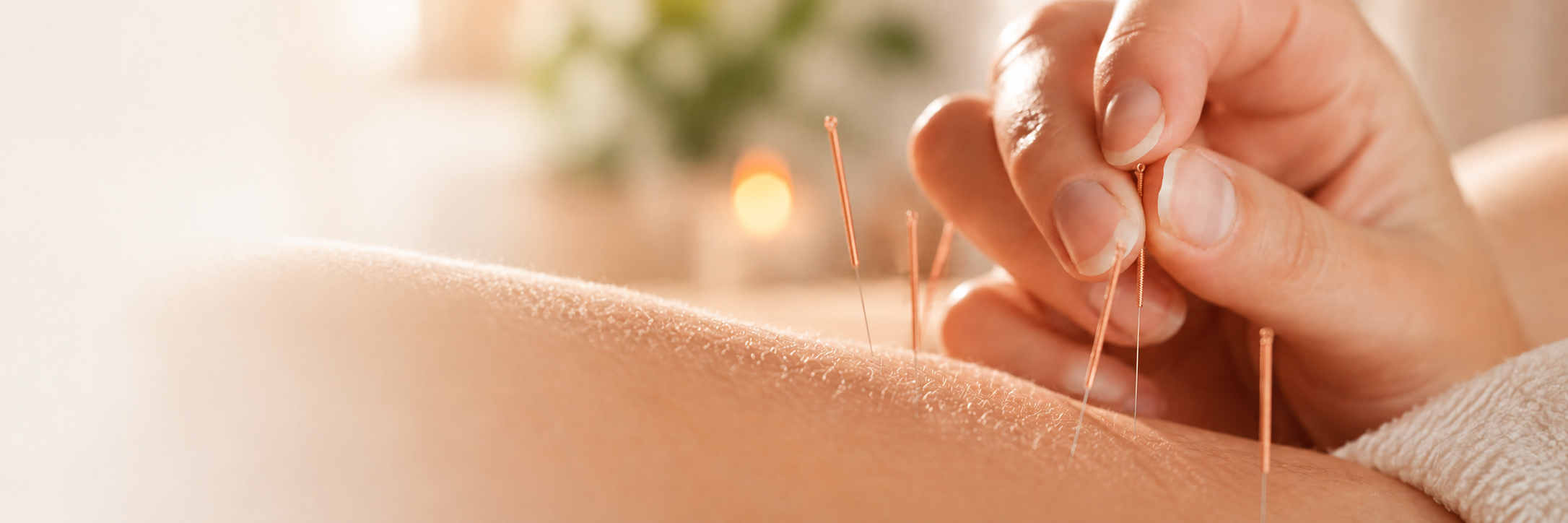 Warme close-up van acupunctuur in een serene spa